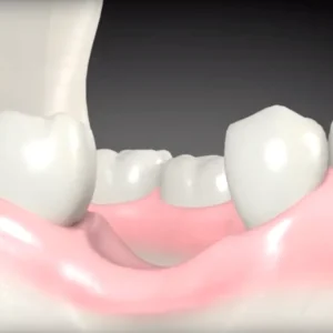 Contemporary	Implant Dentistry