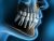 Basics of implant dentistry